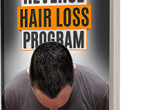 Jerry Williams Reverse Hair Loss