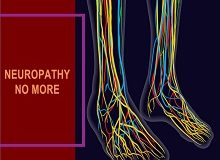 Neuropathy No More Jodi Knapp