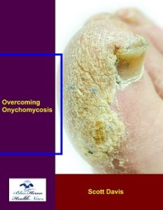 Overcoming Onychomycosis Scott Davis review